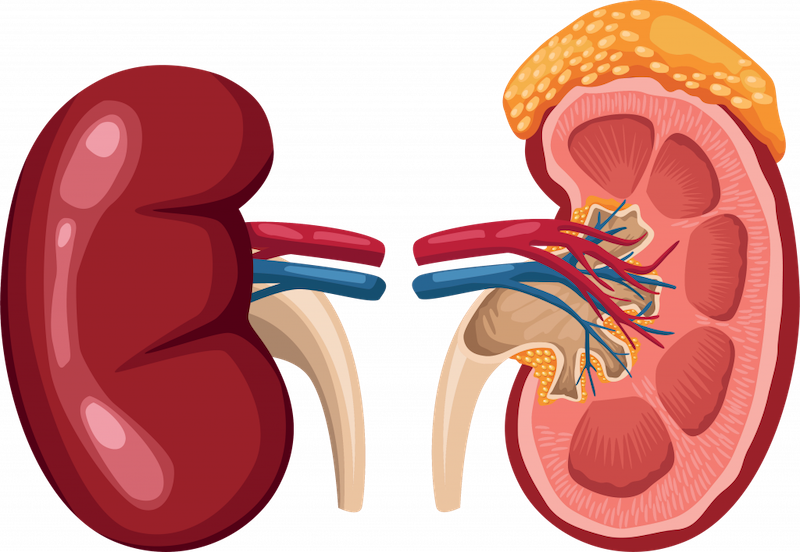 Cáncer de Riñón en Querétaro